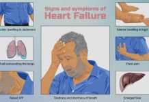 Titanium Device as a Permanent Replacement for a Human Heart